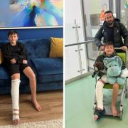 Freddie Frape, 12, broke his leg when he was hit by a car in Woodingdean
