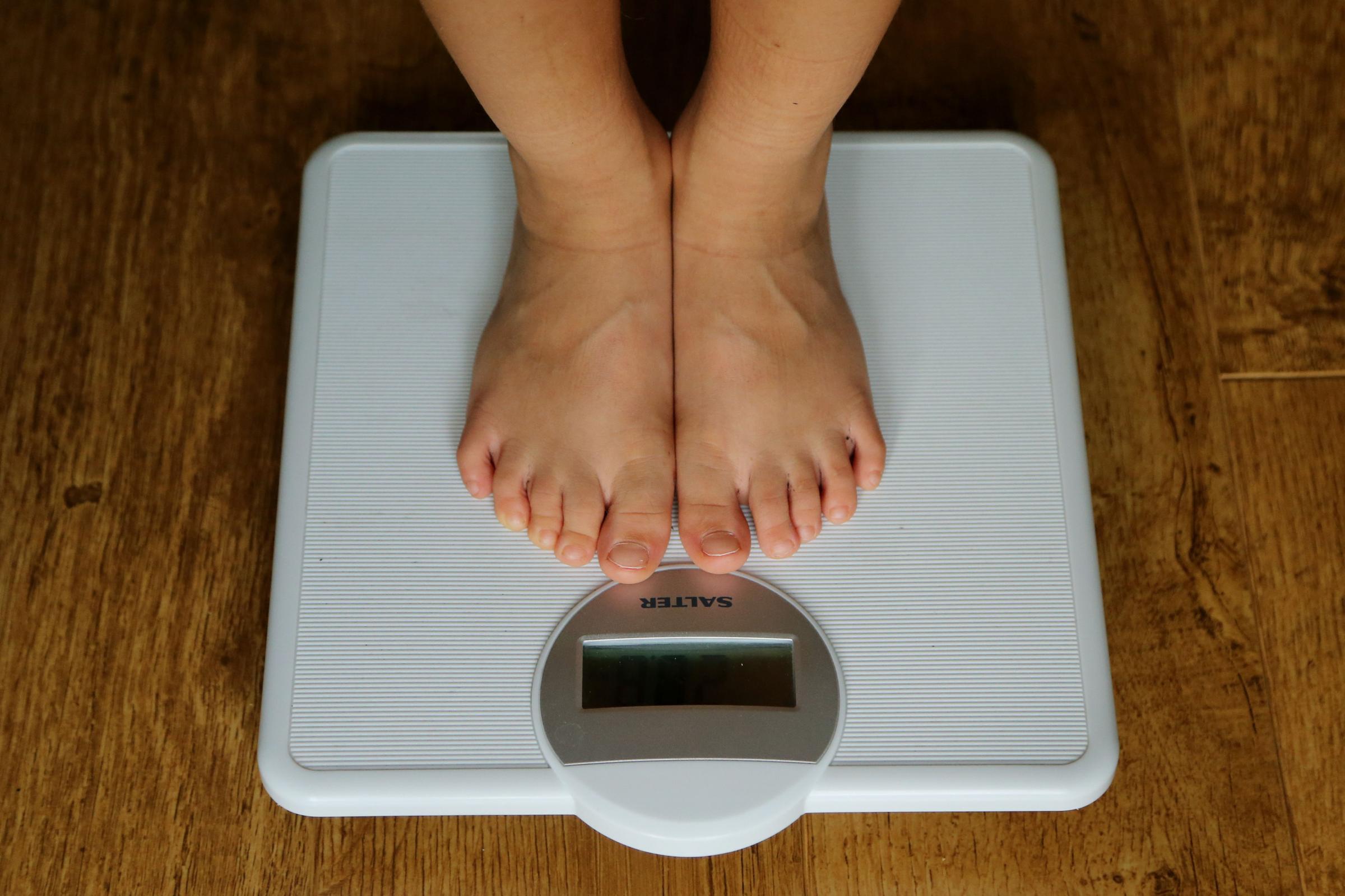 LETTER TO THE EDITOR: Councils should consider taking overweight children into care