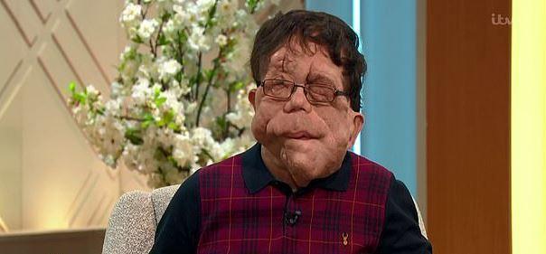 Question Time Adam Pearson To Appear On c Show Tonight The Argus