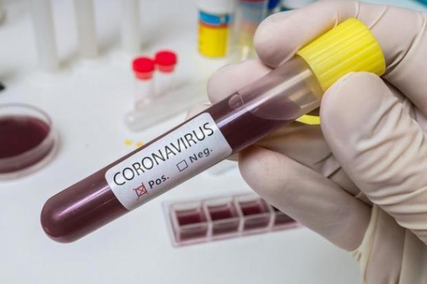 The Argus: Coronavirus testing
