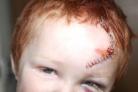 Brighton toddler suffers horrific injuries after cyclist smash