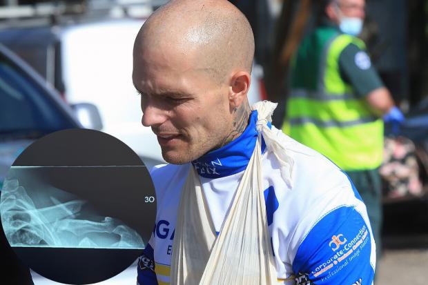 Lewis Kerr in pain at Eastbourne (picture by Mike Hinves) and, inset, his damaged collarbone