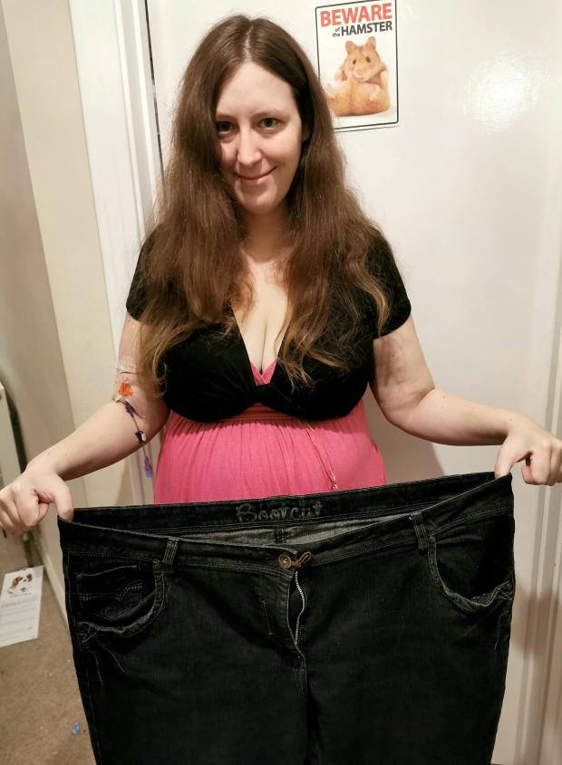 The Argus: Michelle lost a huge amount of weight due to her condition