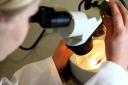 A prostate cancer spit test is better for men with higher genetic risk than a standard blood test, research suggests (David Davies/PA)