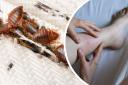Have you ever had to deal with a bedbug infestation in your home?