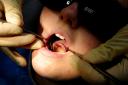 Children were admitted to hospital more than 200 times to have teeth taken out in Sussex last year