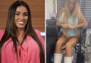 Katie Price has revealed that she was 'pretending to be a horse' when she badly broke both of her feet in 2020