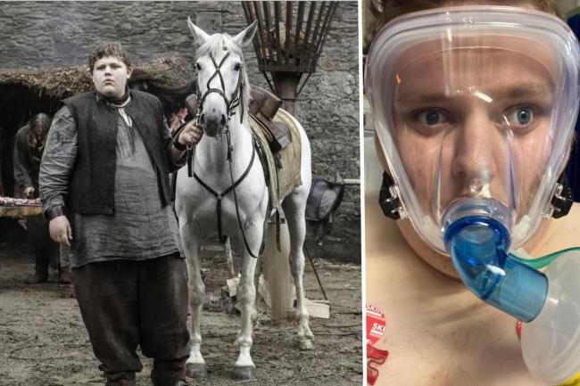 Game Of Thrones actor leaves hospital after six days of emergency Covid-19 treatment