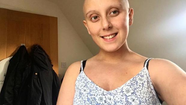 The Argus: Katie Minton, from Worthing, was 17 when she was diagnosed with leukaemia 
