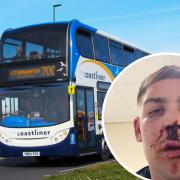 Footage of an assault on a Stagecoach 700 bus last month has been 'lost' by the bus company, police claim