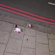A 'trail of blood' was found in Brighton