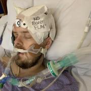 He suffered a traumatic brain injury and was in an induced coma for two weeks