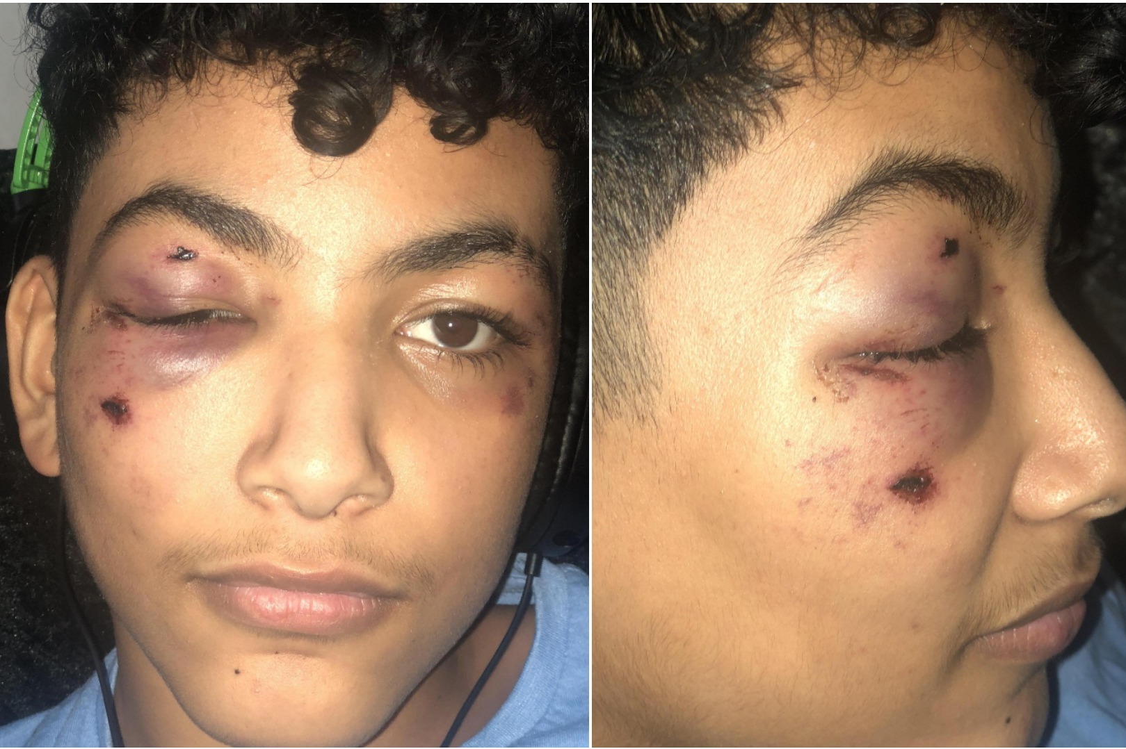 Schoolboy beaten up after posting 'joke' on Snapchat